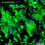Primary cardiomyocytes within GelMA