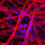 Primary skeletal muscle cells within GelMA
